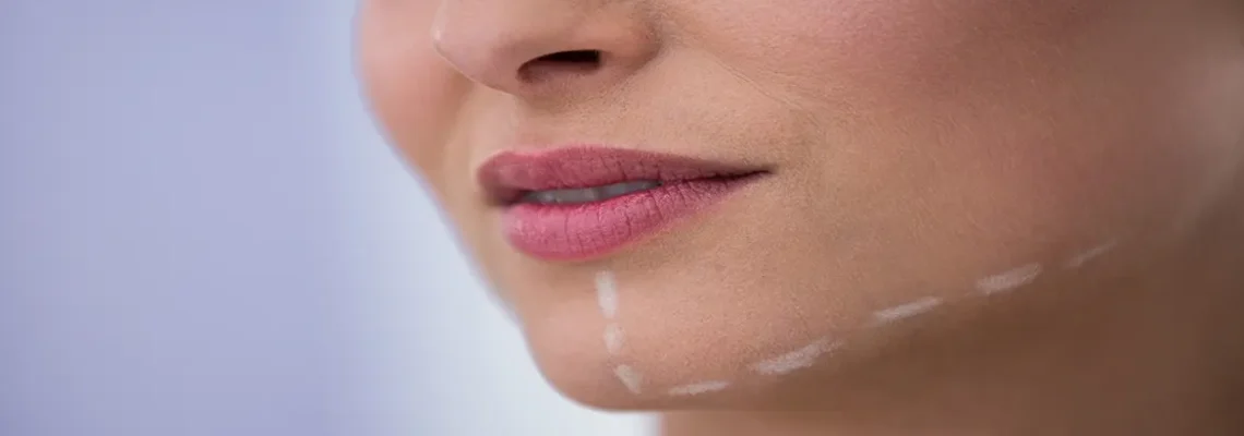 زاویه سازی صورت